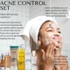 RD Alchemy - Acne Control Serum + Set - Reduce and Control the Appearance of Pimples, Acne, and Zits Naturally for a Clear, Balanced Complexion view 2