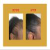 GOOD2GRO Biotin Growth & Thickening Serum - 2oz | Rosemary Oil Infused for Hair Growth, Repair & Restoration | Reduce Thinning & Hair Loss | Vegan & Cruelty-Free view 4