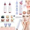 Magik 2-4 Pack Electric Blackhead Comedone Remover Pore Vacuum Cleaner Rechargeable (White, 4 Pack) view 2