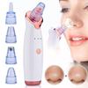Magik 2-4 Pack Electric Blackhead Comedone Remover Pore Vacuum Cleaner Rechargeable (White, 4 Pack) view 3