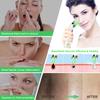 Blackhead Remover Pore Vacuum, Face Suction Pore Cleanser, 5 Suction Power Electric Blackhead Extractor Tool, 4 Probes, Blackhead Suction Remover for Women & Men view 4