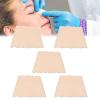 CHOYTONG Thermoplastic Nasal Splints, Nose External Support Protector for Nose Brace Fracture, Rhinoplasty Septoplasty, ENT, Orthopedic Immobilization, Corrugated Shape, 5 PCS (M) view 1