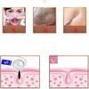 RMENST Blackhead Remover Vacuum Electric Blackhead Removal Tool Facial Pore Cleaner Extractor USB Rechargeable Beauty Device kit with 3 Adjustable Suction & 4 Probes Deep Cleansing (Color : Red) view 3