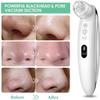 RMENST Blackhead Remover Vacuum Pore Cleaner, Facial Pore Vacuum Acne Whitehead Pimple Extractor with 4 Probes,Electric USB Rechargeable Black Head Remove Tools view 4