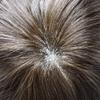 French Lace Hair System for Men 100% Human Hair Replacement Mens Toupee Bleached Knots Hair Units for Man Lace with PU Men Wigs #3 Dark Brown view 4