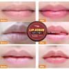 Naturix Lip Scrub for Men & Women 15g view 3