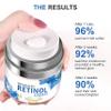Advanced Retinol Dayand Night Face Cream for Face and Eye Area with Anti-Aging Benefits, Reduces Wrinkles and Fine Lines, and Promotes Skin Renewal for Smoother, Healthier-Looking Skin view 3