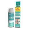 All Acne Treatment - Face and Body - Spot and Full Coverage - Gel Formula - 9 Skin Boosters view 1