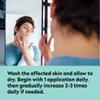 All Acne Treatment - Face and Body - Spot and Full Coverage - Gel Formula - 9 Skin Boosters view 4