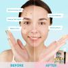 BOJICA 3PCS Clay Face Mask Skincare - Facial Skin Care Mask for Deep Pore Cleansing Turmeric Dead Sea Mud Green Tea Purifying and Hydrating - Reduce Acne Blackheads for Women and Men 2.5 OZ each view 4