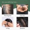 WithBecon Nourisher.zip Hair Serum Ampoule - Highly Concentrated Scalp Treatment for Hair Growth (1.01 fl oz) view 4