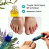 Swissklip Medi-Care Toenail Stick I KlearNail Treatment | Natural Solution for Healthy Nails I Suitable For Foot, Toe, and Fingernail I For Brittle Toenails  10ml / 0.3 Fl. Oz. Pack 2 - Made in USA view 3