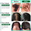 BlueQueen Adivasi Natural Rosemary Oil for Hair Growth, 100% Pure & Natural from Honduras, Promotes Hair Wellness for Men & Women (100ml) (Pack 1) - 3.38 Oz view 4