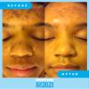 Admire My Skin Dark Spot Corrector Serum + Retinoid Cream Set view 3