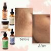 DeHiwi Superfood Skin Care Kit  Dark Spot Essentials Skincare Set Including Spinach Superfood Cleanser, Renew Night Serum, Night Repair Oil, Vitamin C Serum & Soothing Face Cream, Revitalizing Kit view 3
