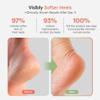 ZenToes Moisturizing Socks for Cracked Heel Treatment, Vitamin E, Olive Oil and Jojoba Oil Heel Socks, Stocking Stuffers for Women, Spa Self Care Gifts for Women (Fuzzy Black, Regular) view 4