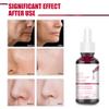 Peeling Solution,AHA 30% + BHA 2% Peeling Solution Fruit Acid Essence Liquid Exfoliating Pores Shrinks Facial Care Serum view 3