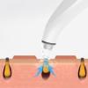 THE PERFECT PART Electric Blackhead Remover Cleaner Face Diamond Pore Vacuum Suction White Heads view 2