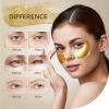 Taimand Under Eye Patches (30 Pairs), 24K Gold Under Eye Mask for Puffy Eyes, Dark Circles,Bags and Wrinkles with Collagen,Relieves Pressure and Reduces Wrinkles,Revitalises and Refreshes Your Skin view 2