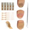 Ingrown Toenail Treatment, Ingrown Toenail Removal Kit, 50pcs Ingrown Toenail Correction Stickers, 50pcs Toenail Corrector Patches, 1pcs Toenail File And Lifter, 1 Roll of Glue-Free Toe Protector view 1