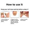 Ingrown Toenail Treatment, Ingrown Toenail Removal Kit, 50pcs Ingrown Toenail Correction Stickers, 50pcs Toenail Corrector Patches, 1pcs Toenail File And Lifter, 1 Roll of Glue-Free Toe Protector view 3