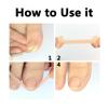 Ingrown Toenail Treatment, Ingrown Toenail Removal Kit, 50pcs Ingrown Toenail Correction Stickers, 50pcs Toenail Corrector Patches, 1pcs Toenail File And Lifter, 1 Roll of Glue-Free Toe Protector view 4