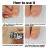 Ingrown Toenail Treatment, Removal Kit, 50pcs Transparent Ingrown Toenail Corrector Strips, 50pcs Toenail Corrector Patches, 1pcs Ingrown Toenail File And Lifter, 1 Roll of Glue-Free Toe Protector view 3
