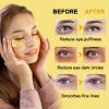YMEYFAN Under Eye Patches, 2000 Pairs 24K Gold Collagen Under Eye Mask Skincare Bulk Wholesale for Spa Salon Estheticians, Puffiness Eyes Dark Circles Treatments, Rreduce Wrinkles Fine Lines Firm Skin view 3