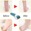 QIYUDS Electric Callus Remover Foot Scrubber, Remover Pedicure Tools for Feet Electronic Callus Shaver Pedicure kit for Cracked Heels and Dead Skin with 2 Roller Heads view 4