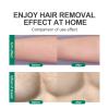 Crystal Hair Removal Magic Crystal Hair Eraser For Women And Men Physical Exfoliating Tool Painless Hair Eraser Removal Tool For Legs Back Arms (Black) view 4