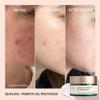 Biossance Squalane + Probiotic Balancing Face Gel Moisturizer - Advanced Formula for Oily & Acne-Prone Skin, Encapsulated Probiotics, Reduces Redness & Excess Oil, Soothes Sensitive Skin - 1.69 oz view 3