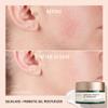 Biossance Squalane + Probiotic Balancing Face Gel Moisturizer - Advanced Formula for Oily & Acne-Prone Skin, Encapsulated Probiotics, Reduces Redness & Excess Oil, Soothes Sensitive Skin - 1.69 oz view 4
