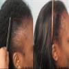 Scalp & Hair Treatment Pack of 2 with Black Seed Oil-Thick and Full & Biotin Infused-Finishing, Repair and Soothing - For irritated, Itchy Scalp - For Hair growth - view 2