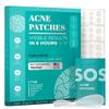 Hydrocolloid Pimple Patches (Made in Korea) FSA/HSA Eligible - Vegan, Hypoallergenic, Cruelty-Free Acne Circle Stickers for Overnight Use, for Zits, Spots, Pimples, Whiteheads (171 Count, Mixed Sizes) view 1