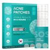 Hydrocolloid Pimple Patches (Made in Korea) FSA/HSA Eligible - Vegan, Hypoallergenic, Cruelty-Free Acne Circle Stickers for Overnight Use, for Zits, Spots, Pimples, Whiteheads (110 Count, Mixed Sizes) view 1