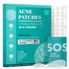 Hydrocolloid Pimple Patches (Made in Korea) FSA/HSA Eligible - Vegan, Hypoallergenic, Cruelty-Free Acne Circle Stickers for Overnight Use, for Zits, Spots, Pimples, Whiteheads (54 Count, 12mm) view 1