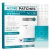Hydrocolloid Pimple Patches (Made in Korea) FSA/HSA Eligible - Vegan, Hypoallergenic, Cruelty-Free Acne Circle Stickers for Overnight Use, for Zits, Spots, Pimples, Whiteheads (220 Count, Mixed Sizes) view 1