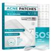 CLEOF Pimple Patches for Face & Body - Overnight Use, Invisible Acne Patch for Zits, Spots, Pimples, Whiteheads, Vegan, Cruelty-Free, Hypoallergenic Hydrocolloid Stickers (48 Count, 10mm) view 1