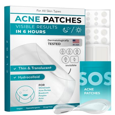 Hydrocolloid Pimple Patches (Made in Korea) FSA/HSA Eligible - Vegan, Hypoallergenic, Cruelty-Free Acne Circle Stickers for Overnight Use, for Zits, Spots, Pimples, Whiteheads (172 Count, Mixed Sizes)