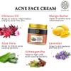 Buddha Natirals anti acne face cream 175ml view 4