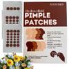 MATCHED Hydrocolloid Pimple Patches-Invisible Acne Patches for Face, 3 Sizes, 72-Count (1 Pack),Zit patches that match Skin tone for Daytime Use, for proactive acne treatment (NRB) view 1