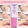 Skin Epilator, Hair Remover for Face - Epilators, Skin Epilators for Face, Skin Hair Remover for Women(1PCS) view 4