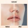 SEIHAI Facial Hair Removal for Women, Hair Removal Device(Luxury), Face Razors for Women, Facial Hair Remover for Face, Lip, Chin, Included 4 x Replacement Heads view 3