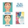 SunBurnt Gel 6Fl Oz and Face Mask 4pack After Sun Skin Care Bundle, Advanced Sun Recovery, Treat Dry Sun Damaged Skin, For After Sun Exposure, Much More than Aloe, Soothes and Rehydrates Hot Dry Skin view 2