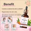 Verem Stretch Marks Ayurvedic Oil With Powerful Ingredients- 100% Ayurvedic, Increases Skin Elasticity, 30 Ml view 3
