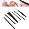 6pcs / set Pedicure Knife Set for Feet, Ingrown Toe Nail Correction Pedicure Tools Kit, Stainless Steel Toenail Clipper Set for Nail Corn Callus with Storage Box(A) view 3
