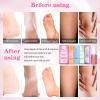 nbc BeautiLab Pedicure Foot Soak Set - Upgraded 6 in 1 Foot Spa, Foot Bath Spa, Pedicure Kit, Foot Soak for Tired & Dry Cracked Feet, Athletes Feet, Bad Odor, Softens Calluses (Rose) view 3