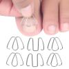 Ingrown Toenails Pedicure,Ingrown Toenails Pedicure Tools, Toenail Correction Tools Toenail Correction Clips to Correct Ingrown Toenails Foot Care Correction Tools view 2