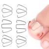 Ingrown Toenails Pedicure,Ingrown Toenails Pedicure Tools, Toenail Correction Tools Toenail Correction Clips to Correct Ingrown Toenails Foot Care Correction Tools view 4
