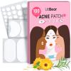 LitBear Large Acne Pimple Patches, 6 Sizes 100 Patches for Large Breakouts, Acne Patches for Face, Chin or Body, Acne Spot Patch with Tea Tree & Calendula Oil, Hydrocolloid Bandages for Acne Skin view 1